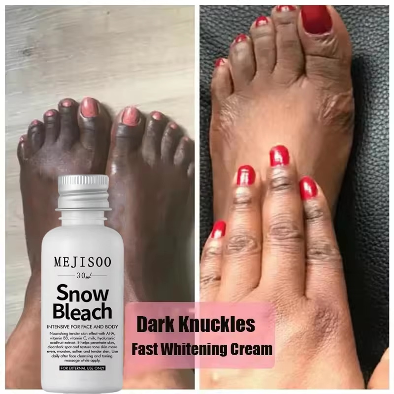 Fast Whitening Dark Knuckles B - Korean Skincare Routine review and price