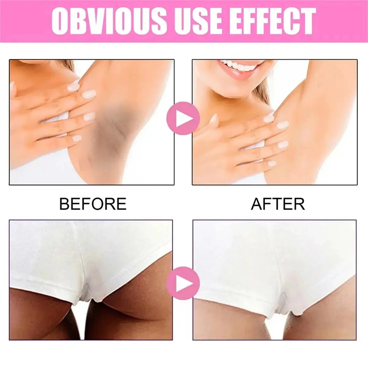 Fast Whitening Dark Knuckles B - Korean Skincare Routine review and price
